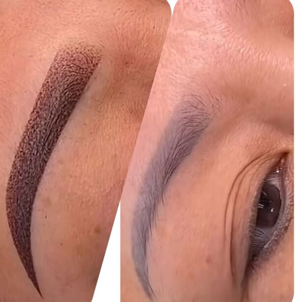Neutralización de Cejas
