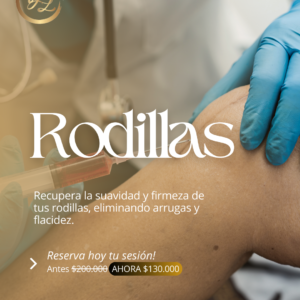 Plasma Rodillas